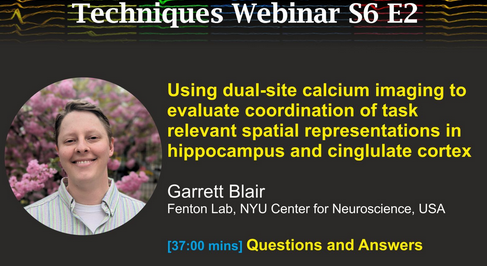 Cambeidge Neuro link